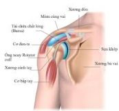 Hội chứng Rotator cuff - Triệu chứng, nguyên nhân và cách điều trị