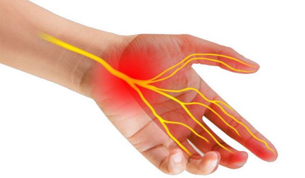 Hội chứng ống cổ tay - Triệu chứng, nguyên nhân và cách điều trị