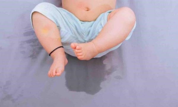 Bệnh đái dầm - Triệu chứng, nguyên nhân và cách điều trị