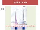 Xét nghiệm điện di Hemoglobin - Quy trình thực hiện và những lưu ý cần biết
