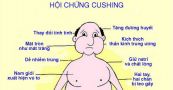 Hội chứng Cushing - Triệu chứng, nguyên nhân và cách điều trị