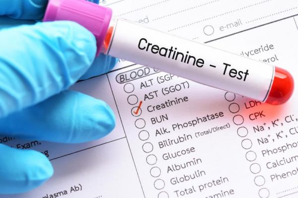 Xét nghiệm định lượng creatinin máu - Quy trình thực hiện và những lưu ý cần biết