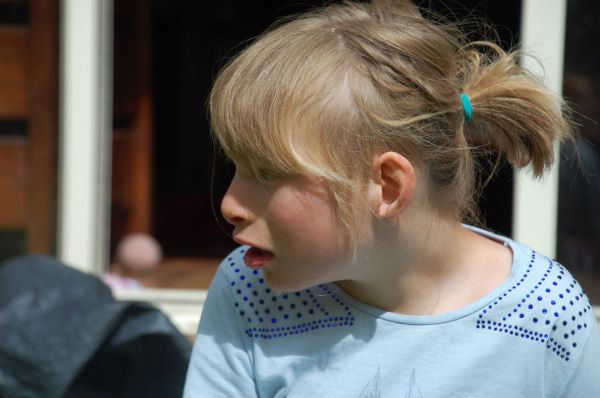 Hội chứng Cri du chat - Triệu chứng, nguyên nhân và cách điều trị