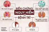 Trĩ - Triệu chứng, nguyên nhân và cách điều trị