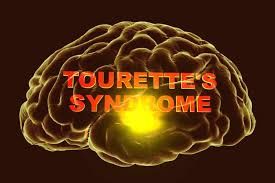 Hội chứng Tourette - Triệu chứng, nguyên nhân và cách điều trị