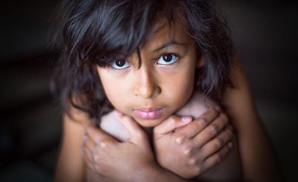 Bệnh ấu dâm - Triệu chứng, nguyên nhân và cách điều trị