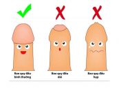 Bệnh hẹp bao quy đầu - Triệu chứng, nguyên nhân và cách điều trị