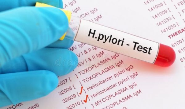 Xét nghiệm H. pylori - Quy trình thực hiện và những lưu ý cần biết