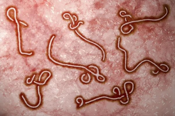Bệnh Ebola - Triệu chứng, nguyên nhân và cách điều trị