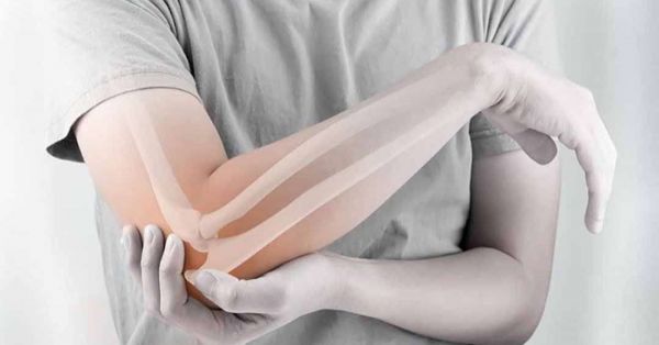 Bệnh gãy vỡ xương khuỷu tay - Triệu chứng, nguyên nhân và cách điều trị