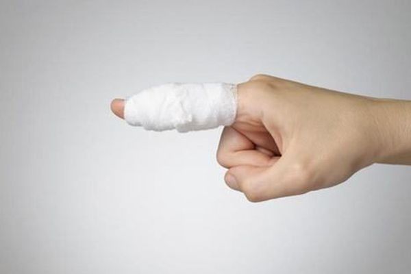 Bệnh gãy xương ngón tay - Triệu chứng, nguyên nhân và cách điều trị
