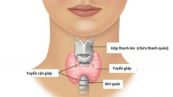 Bệnh cường cận giáp - Triệu chứng, nguyên nhân và cách điều trị
