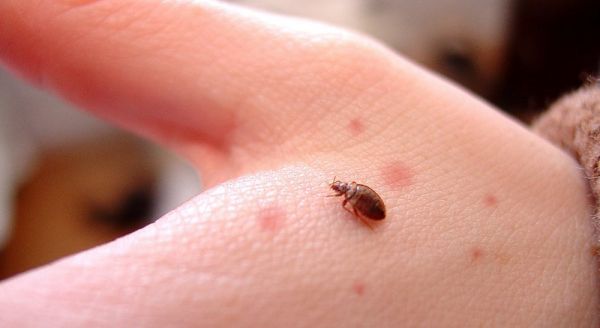 Bệnh côn trùng đốt - Triệu chứng, nguyên nhân và cách điều trị