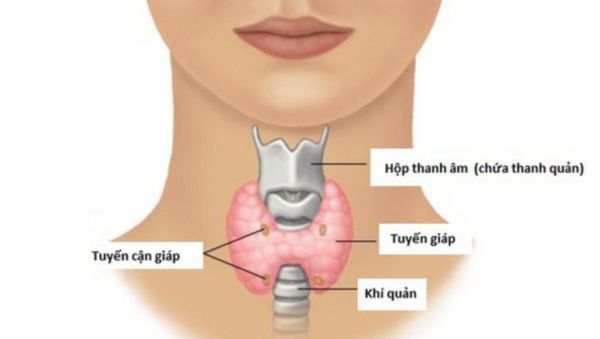 Bệnh cường cận giáp - Triệu chứng, nguyên nhân và cách điều trị