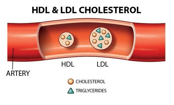Xét nghiệm Cholesterol và triglycerid - Quy trình thực hiện và những lưu ý cần biết