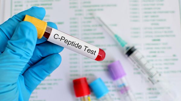 Xét nghiệm C-peptide - Quy trình thực hiện và những lưu ý cần biết