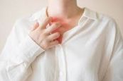 Bệnh ban đỏ erythema migrans - Triệu chứng, nguyên nhân và cách điều trị
