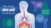 Bệnh phổi - Triệu chứng, nguyên nhân và cách điều trị