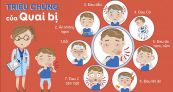 Bệnh quai bị - Triệu chứng, nguyên nhân và cách điều trị