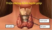 Bệnh tuyến giáp - Triệu chứng, nguyên nhân và cách điều trị