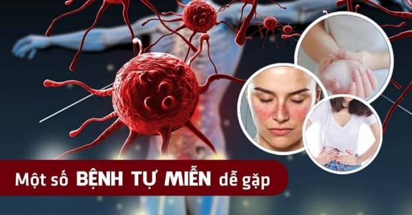Bệnh tự miễn - Triệu chứng, nguyên nhân và cách điều trị